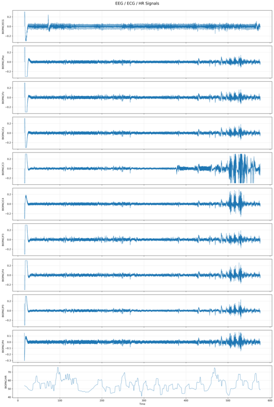 EEG Linien untereinander