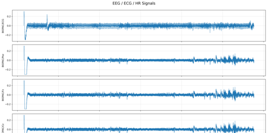 EEG Linien untereinander